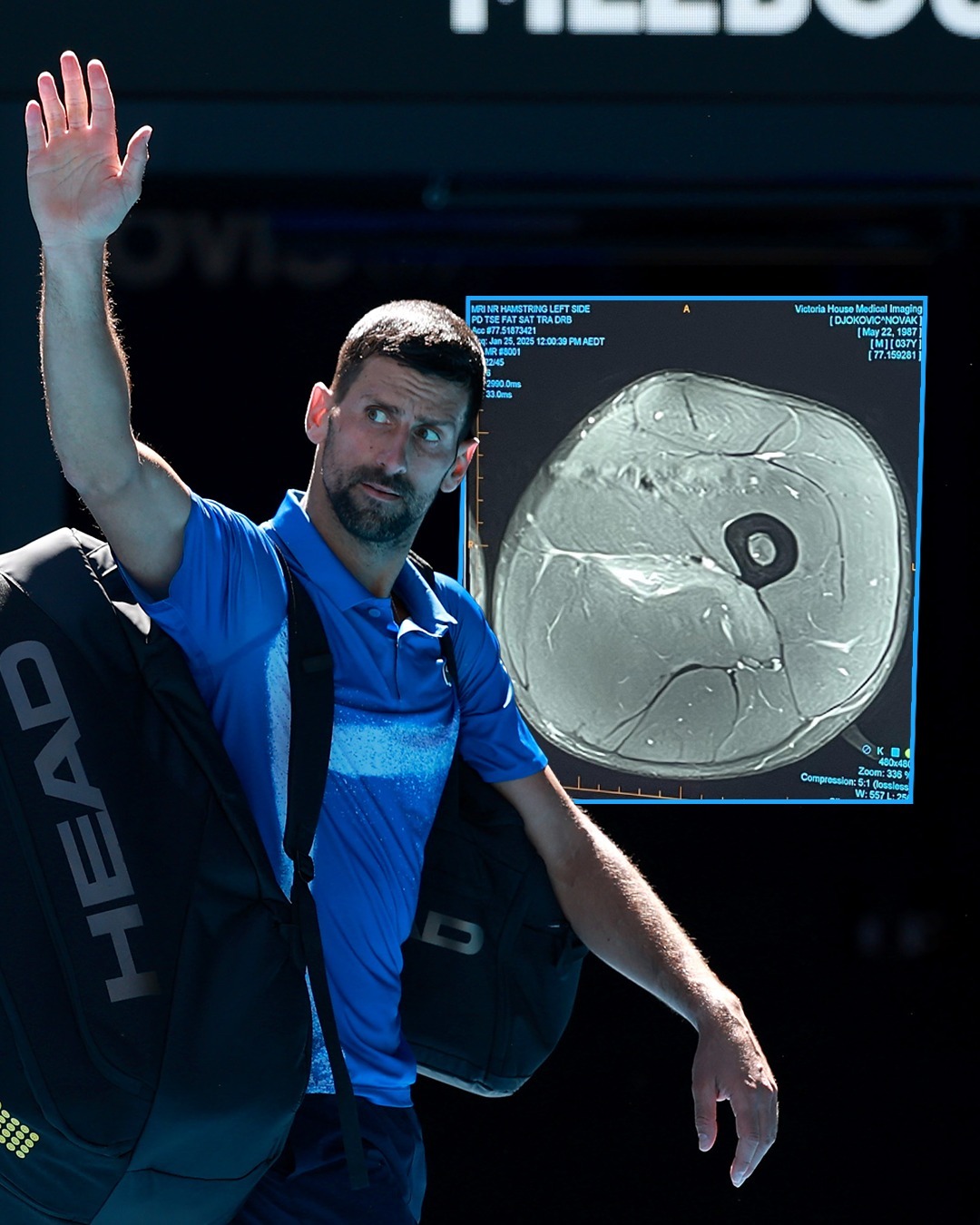 年终总决赛鏖战澳网，德约科维奇状态火热